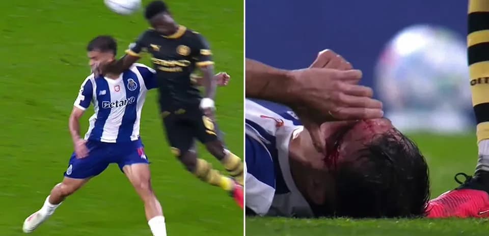Jugador de Porto cae tras recibir un golpe en la cara