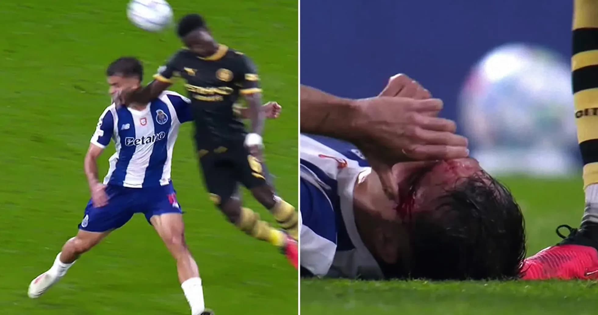 Jugador de Porto cae tras recibir un golpe en la cara Jugador de Porto cae tras recibir un golpe en la cara